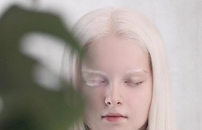 Amina Ependieva, la chica de hielo con ojos de diferentes colores