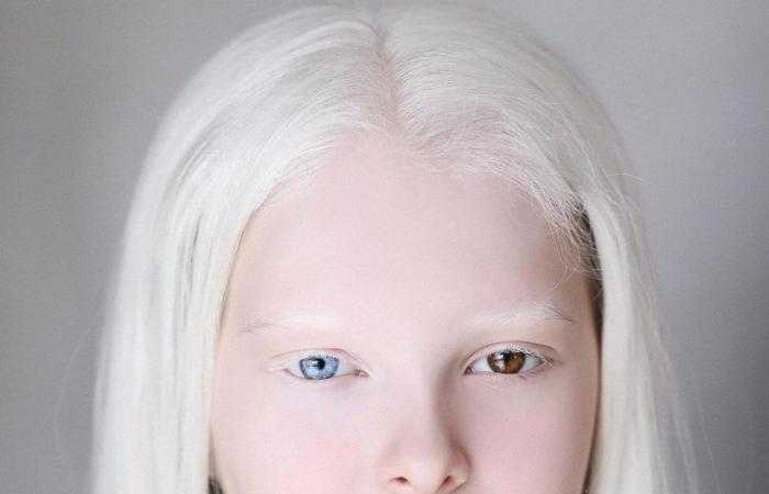 Amina Ependieva, la chica de hielo con ojos de diferentes colores