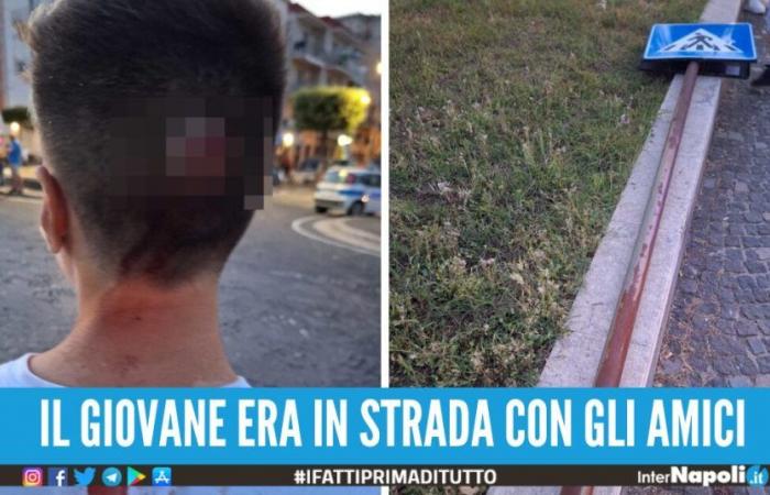 Herido en la cabeza por un poste de señalización mientras caminaba por la calle, casi una tragedia en Pozzuoli