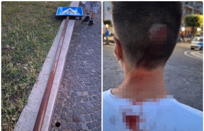 Un poste de señalización se suelta y golpea a un niño en la cabeza, al borde de la tragedia en Pozzuoli
