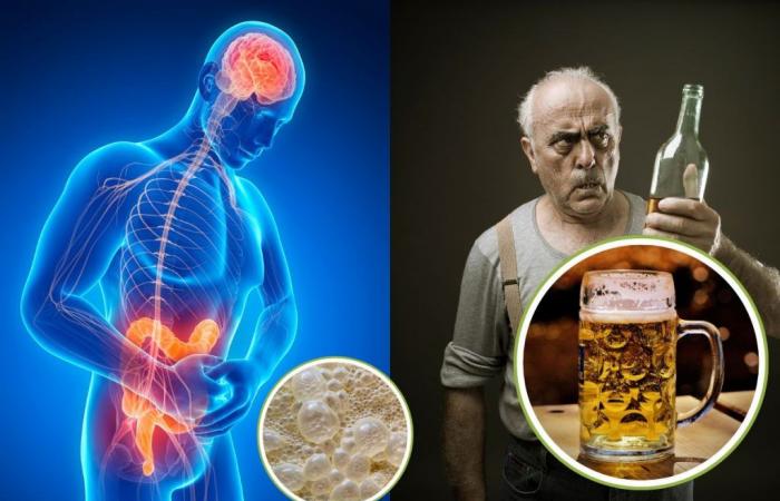 Esta rara enfermedad hace que te emborraches sin beber: el misterioso caso del síndrome de fermentación intestinal (ABS)