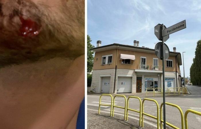 Udine, niño atacado después del turno de trabajo en Lampara. Otro empleado acosado por un hombre en un coche. El estallido de los propietarios