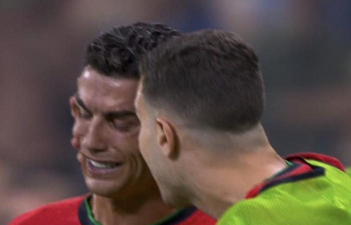 Euro 2024, Cristiano Ronaldo falla el (primer) penalti contra Eslovenia y rompe a llorar. Pero Diogo Costa arrastra a Portugal a los cuartos de final – El vídeo