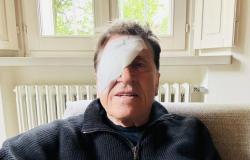 Gianni Morandi con un ojo vendado en las redes sociales. Miedo por el cantante