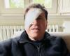 Gianni Morandi publica una foto con un llamativo parche en el ojo: que pasó