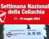 Durante la semana nacional de la enfermedad celíaca, iniciativa MAPE en Turi en Matera