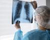 Cáncer de pulmón avanzado, el tratamiento dirigido reduce el riesgo de muerte